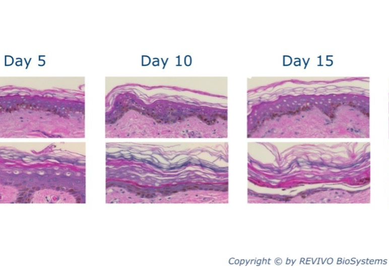ヒト皮膚摘出片の生存性
