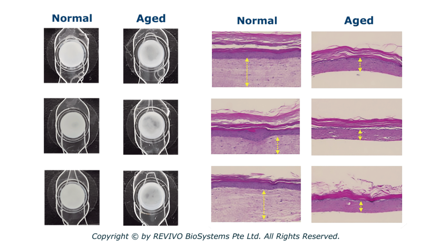 慢性的老化皮膚モデル