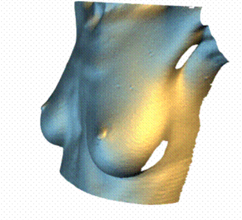 胸部の3次元画像