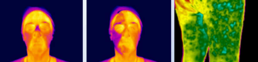顔、太もも表面の温度画像