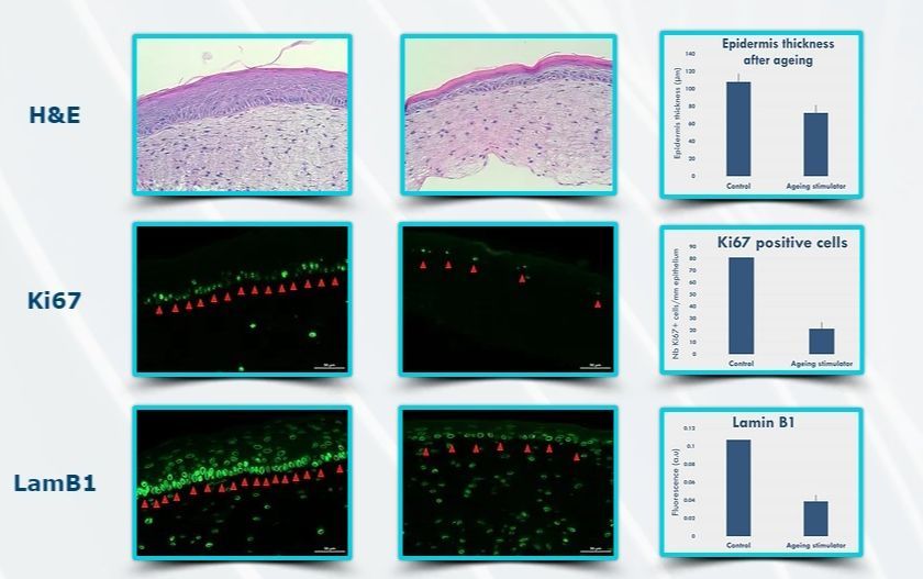 年代別老化モデル