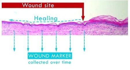 4D組織皮膚モデル