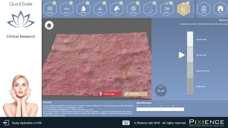 ３Dによるラフネスの測定